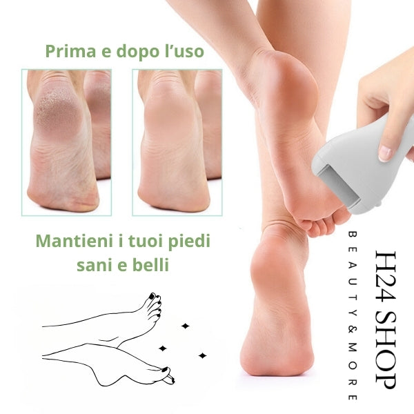 Dispositivo elettrico per Pedicure USB Ricaricabile